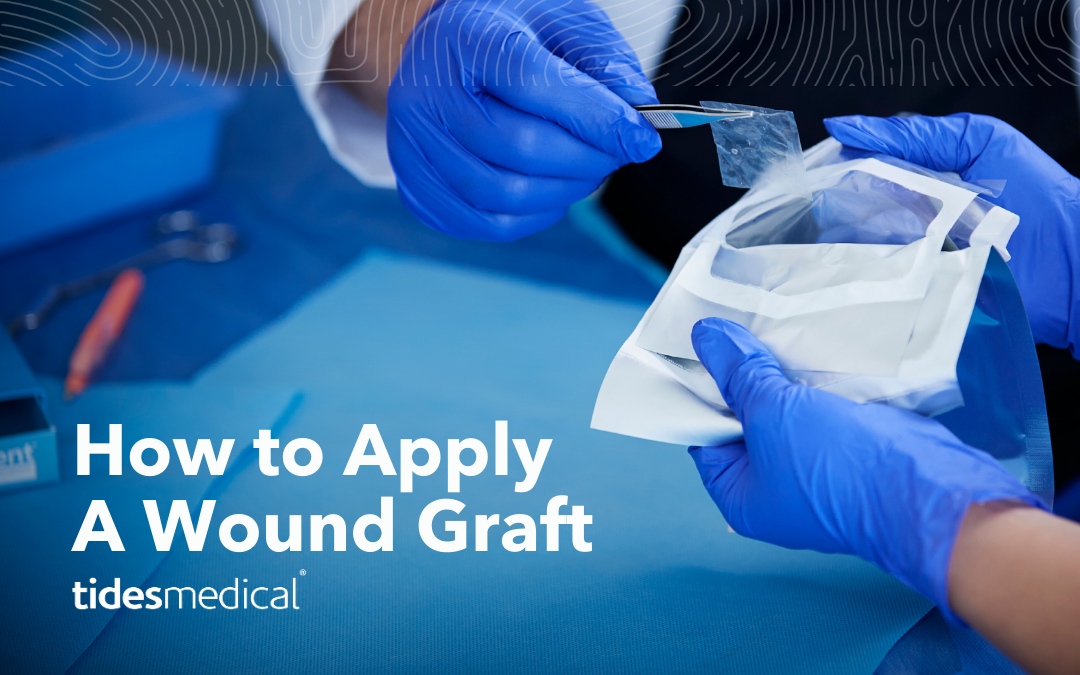 How to Apply A Wound Graft