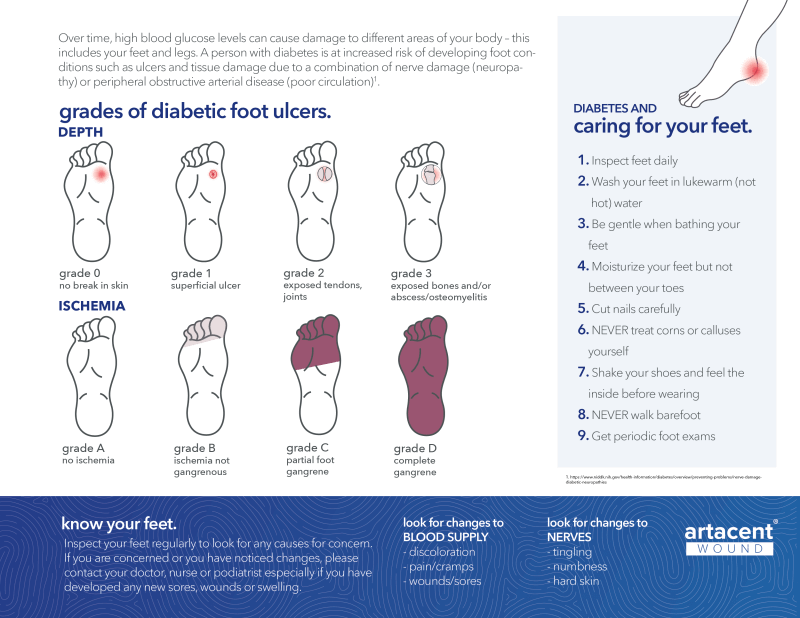 Diabetic Foot Ulcers – What You Need To Know