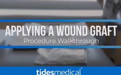 How to Apply A Wound Graft