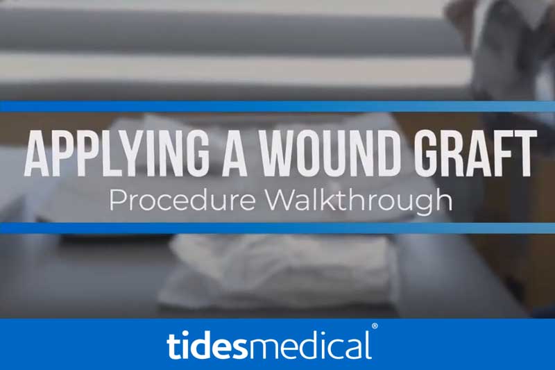 How to Apply A Wound Graft
