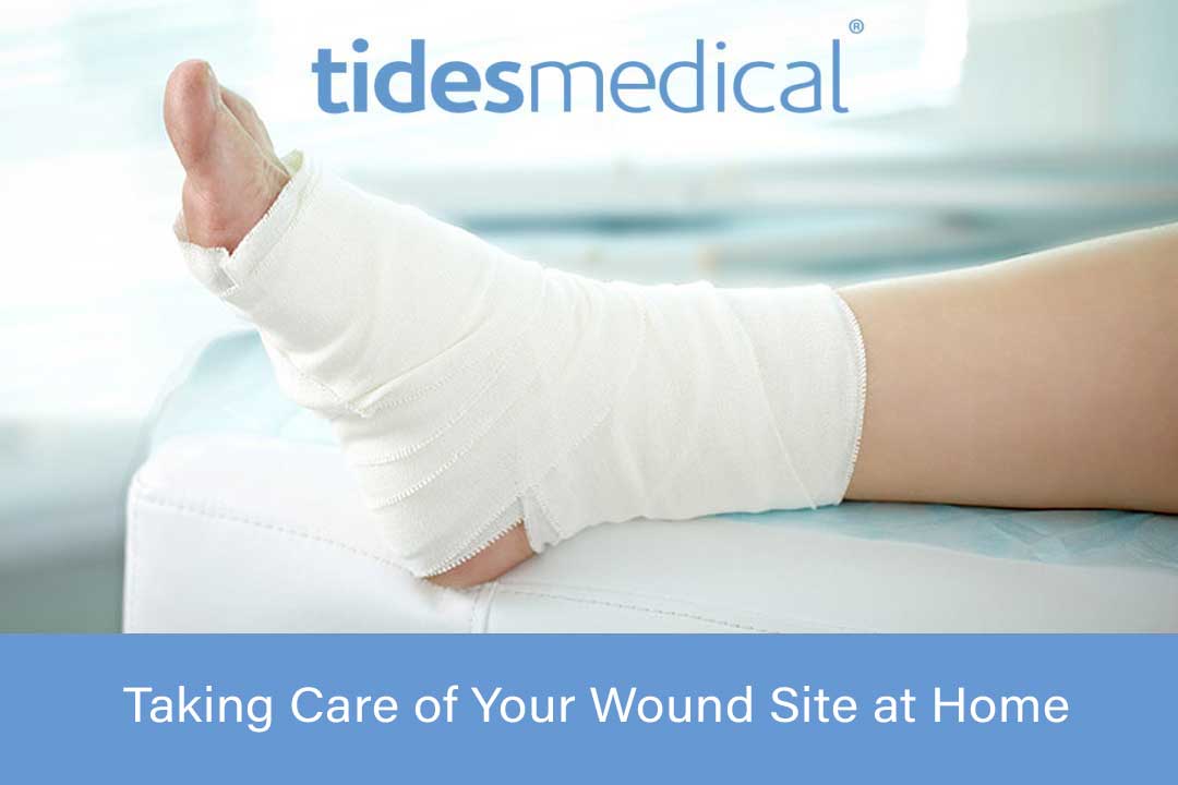 Taking Care of Your Wound Site at Home
