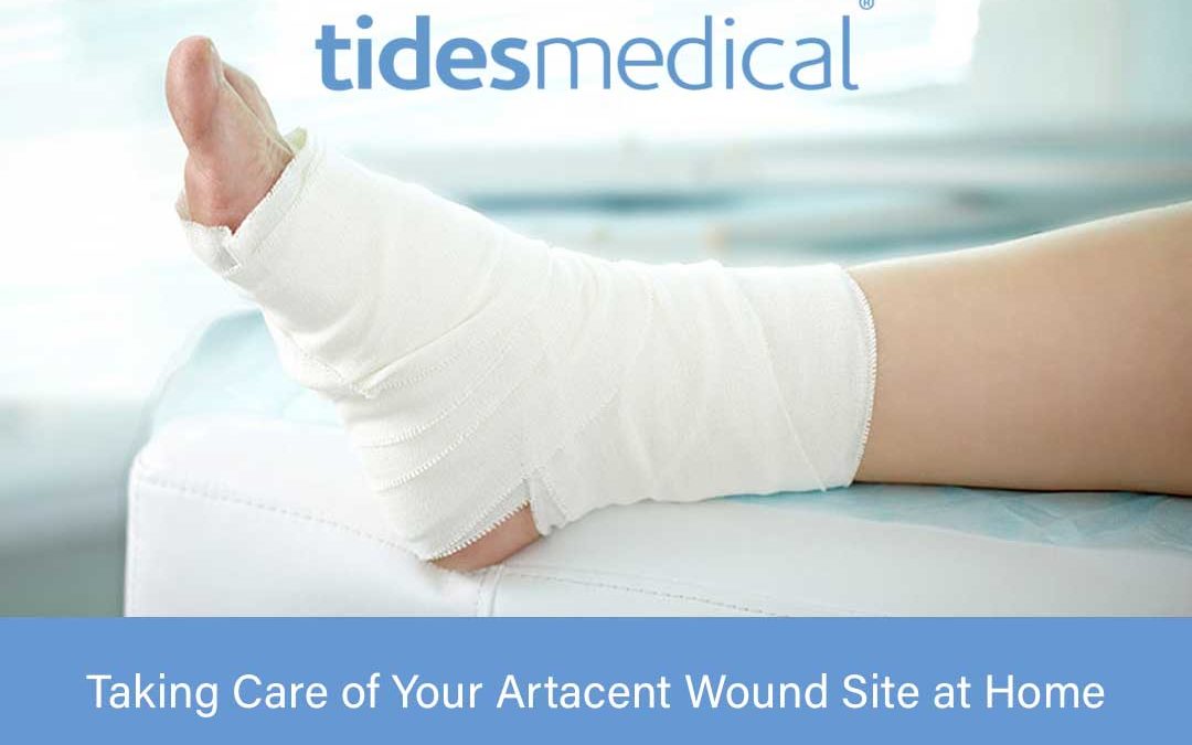 Taking Care of Your Artacent Wound Site at Home