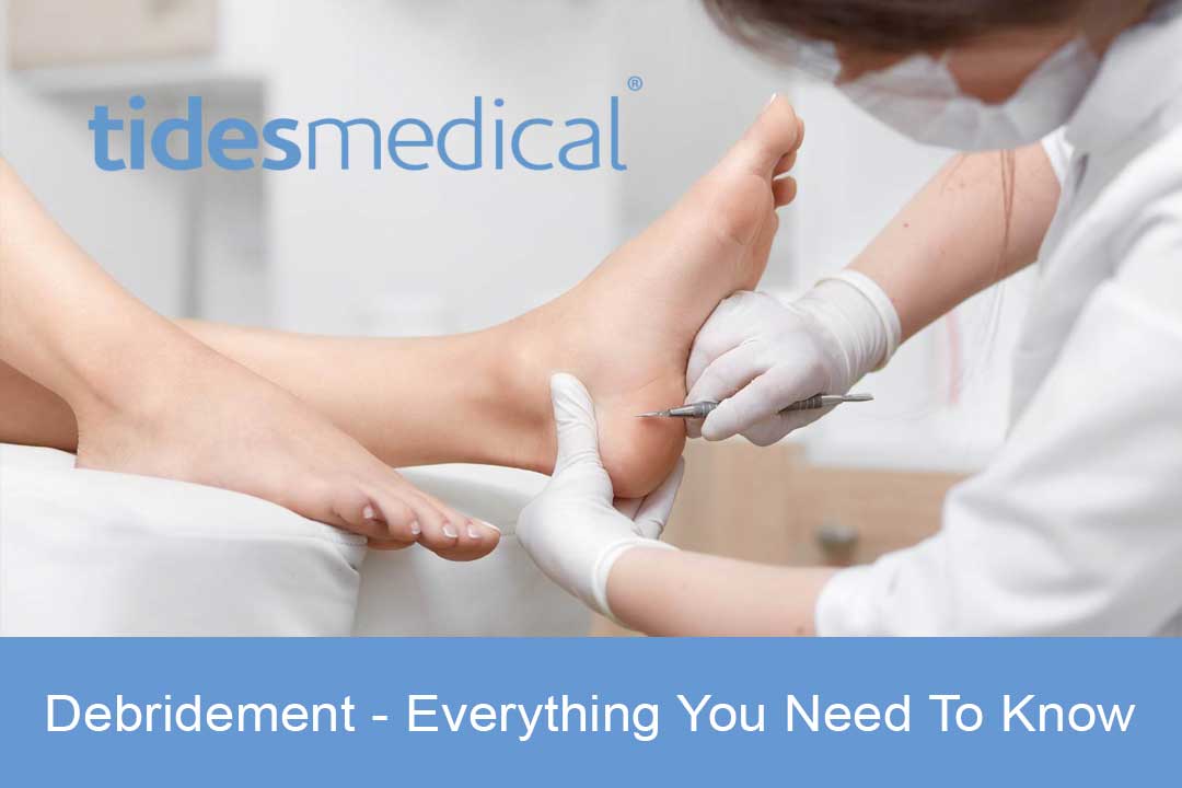 Types of Debridement – Everything You Need To Know