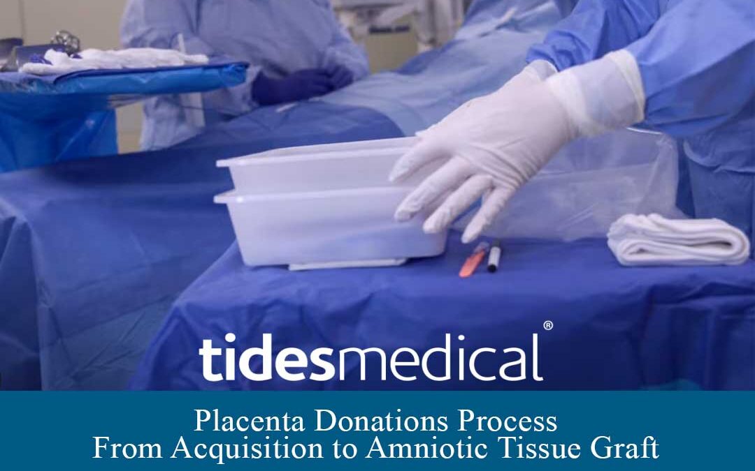 Placenta Donations Process – From Acquisition to Amniotic Tissue Graft