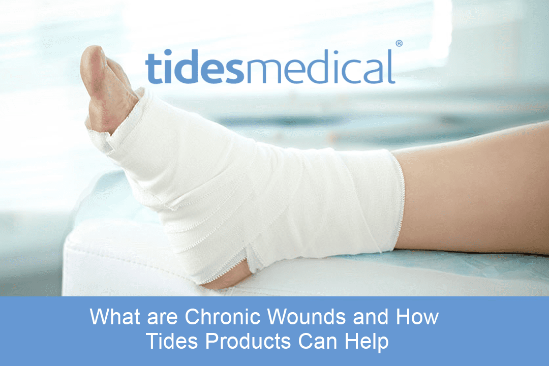 What are Chronic Wounds and How Tides Amniotic Tissue Graft Products Can Help