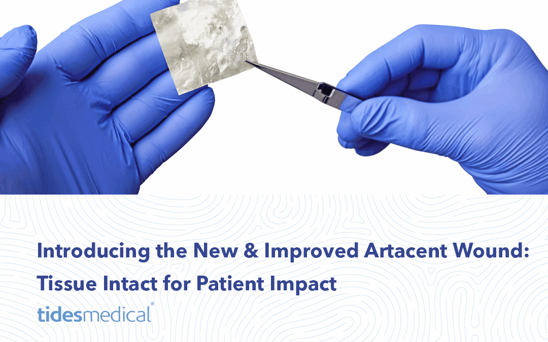 Introducing the New & Improved Artacent Wound: Tissue Intact for Patient Impact