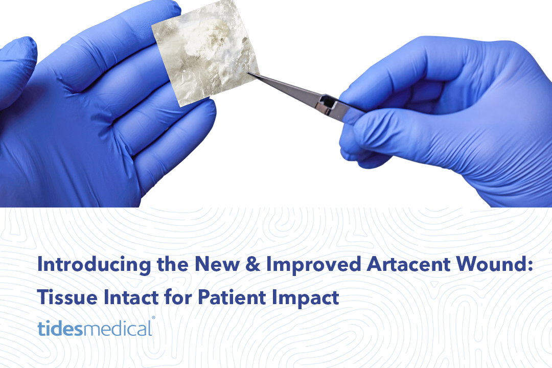 Introducing the New & Improved Artacent Wound: Tissue Intact for Patient Impact
