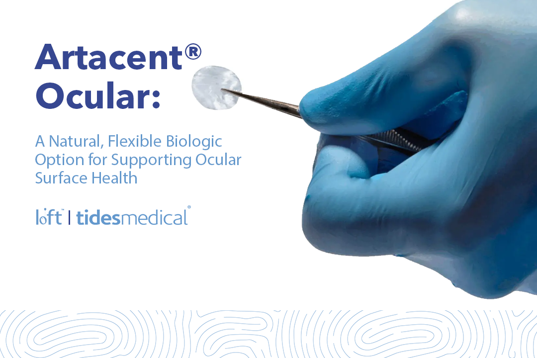 Artacent® Ocular: A Natural, Flexible Biologic Option for Supporting Ocular Surface Health