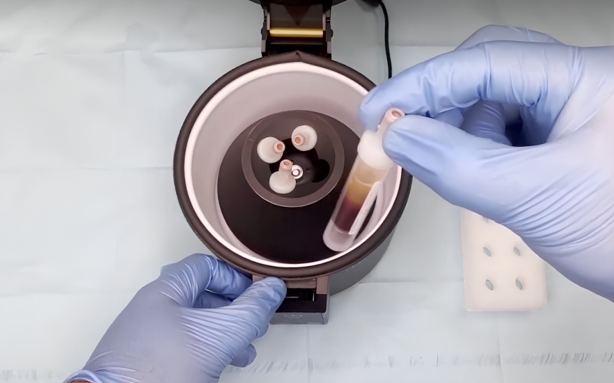 Clinician holds Tides Medical Artacent AC boxes